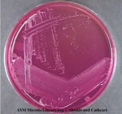 <p>Which Staphylococcus species cannot ferment mannitol?</p>