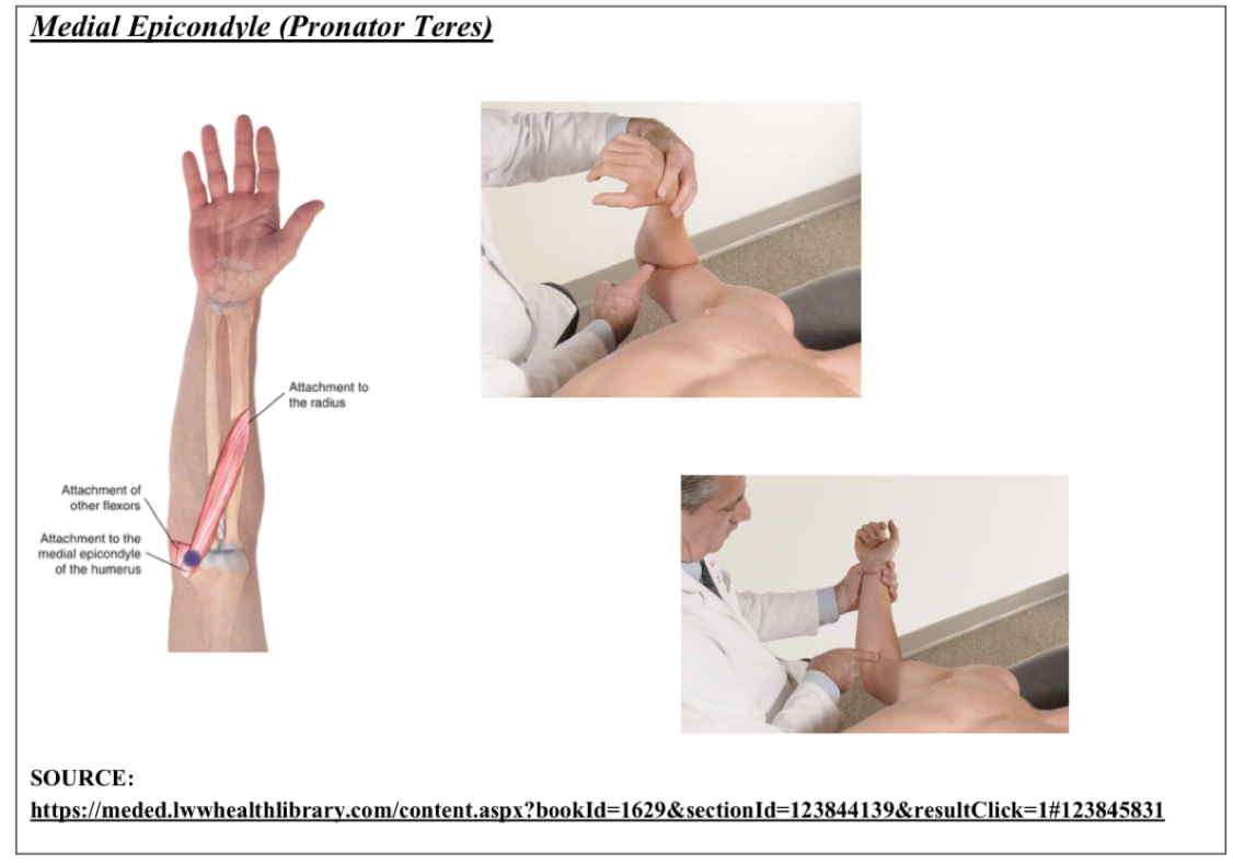 <p>F Pro ADd with slight flexion of wrist</p><p>Point is medial epicondyle of humerus at common flexor tendon and attachment of pronator teres</p><ol><li><p>pt supine, physician on same side of point</p></li><li><p>pt elbow flexed, wrist pronated, forearm slightly adducted, wrist slightly flexed</p></li><li><p>fine tune with elbow flex, wrist pronation, forearm adduction</p></li></ol><p></p>