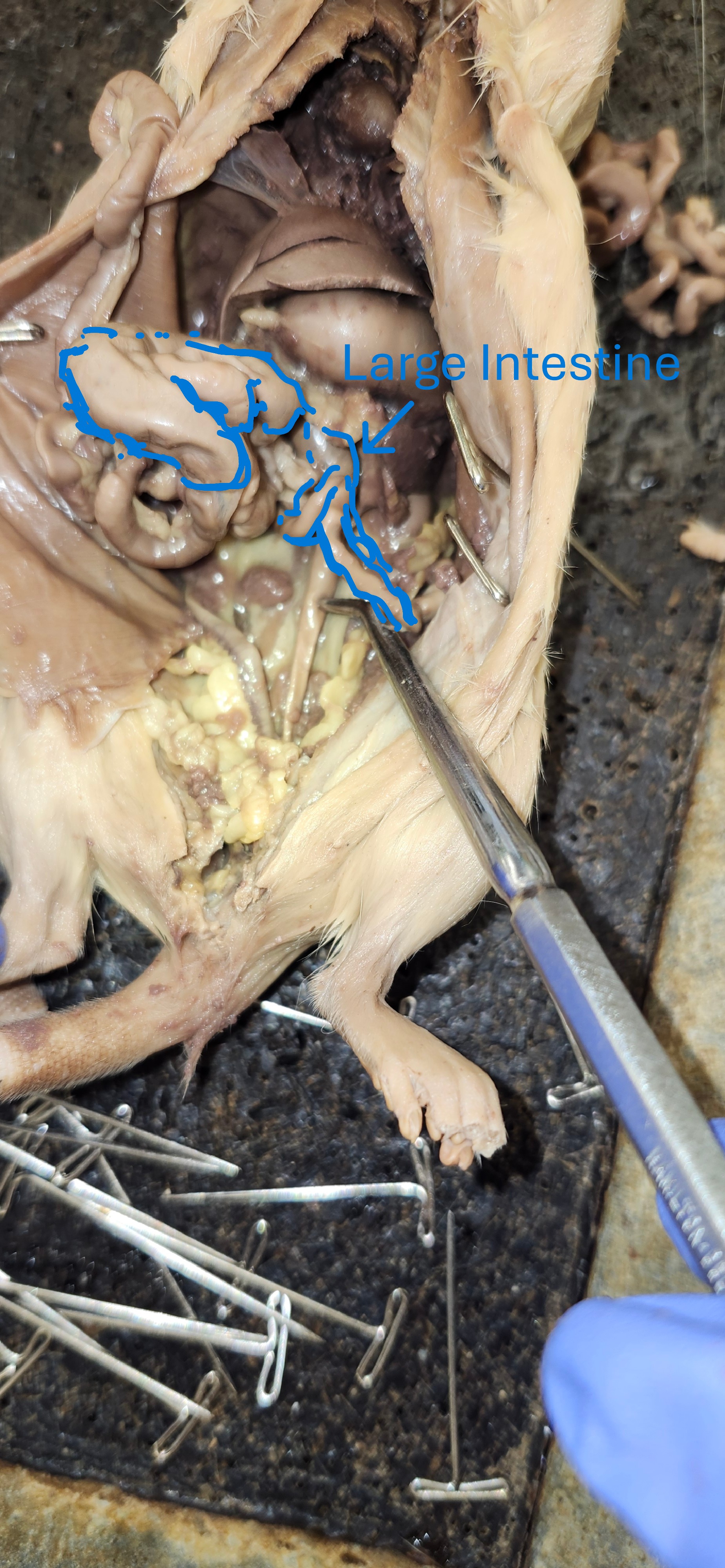 <p>L intestine</p>