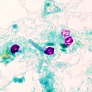 <p>4-6 um oocysts that can have sporozoites present inside? Watery diarrhea coccidia?</p>