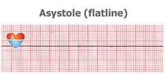 <p>B. epinephrine</p>