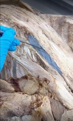 <p>Name the muscle</p>