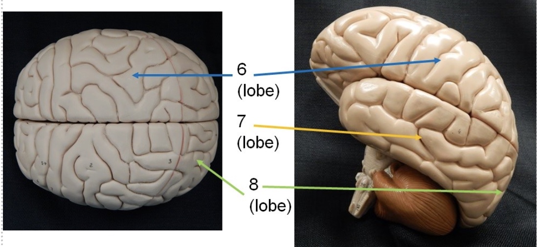 <p>What is the yellow line? (lobe)</p>