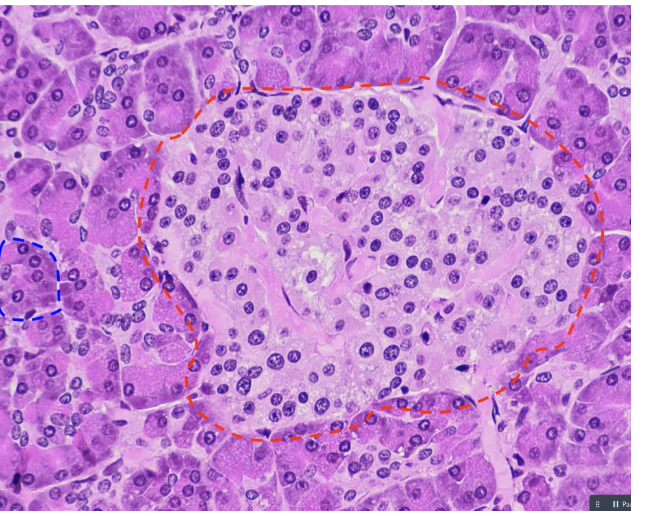 <p>what is outlined in red</p>