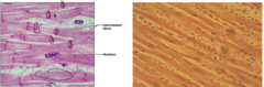 <p>What type of muscle tissue is this?</p>