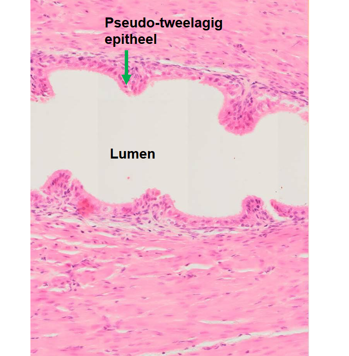 <p>welke structuur (macro)</p>