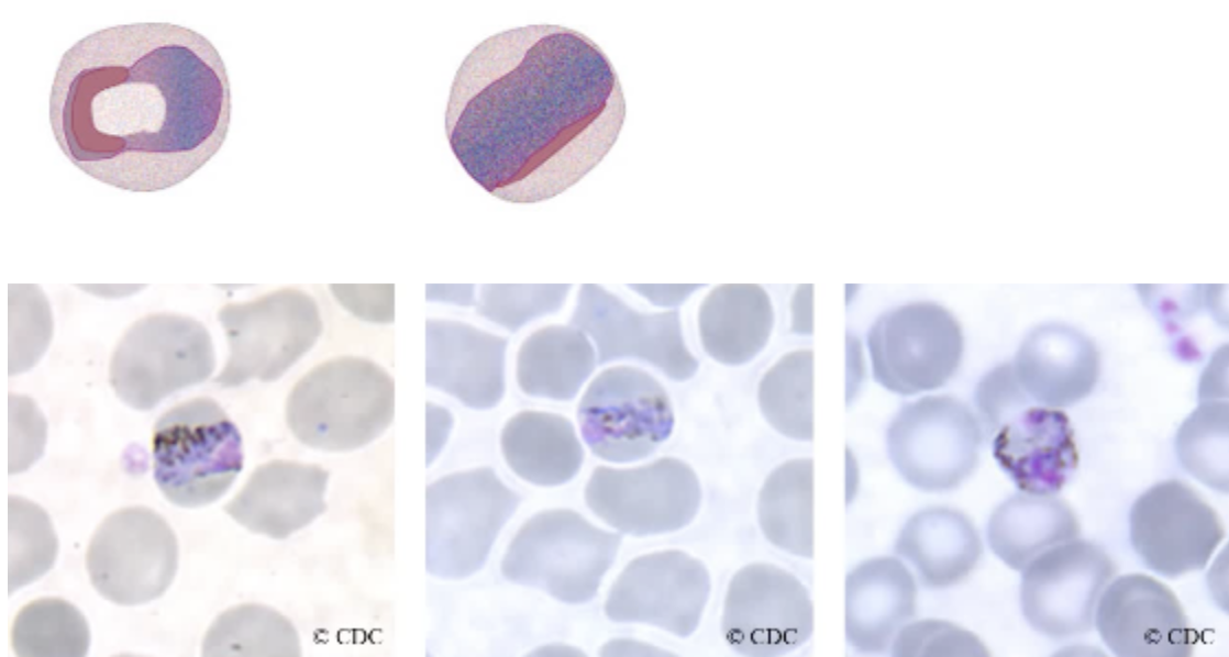 <ul><li><p><span style="background-color: transparent;">The formation of a non-amoeboid solid cytoplasm that may assume an oval, band or bar shape is characteristic for the plasmodium malaria.</span></p></li><li><p><span style="background-color: transparent;">The cytoplasm consists of a coarse dark-brown pigment that often mask the chromatin material. </span></p></li><li><p><span style="background-color: transparent;">Vacuoles are absent in the mature forms of this stage.</span></p></li><li><p><span style="background-color: transparent;"><strong><u>The band and oval shapes are diagnostic</u></strong></span></p></li></ul><p></p>