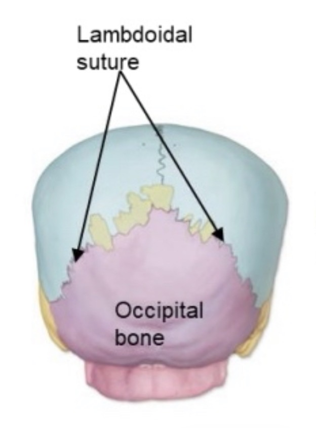 <p>lamboidal suture</p>