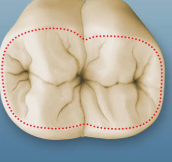 <p>Portion of a crown on a posterior tooth that is bounded by the cusp tips, crest of the marginal ridges, and crests of the cusp ridges</p>