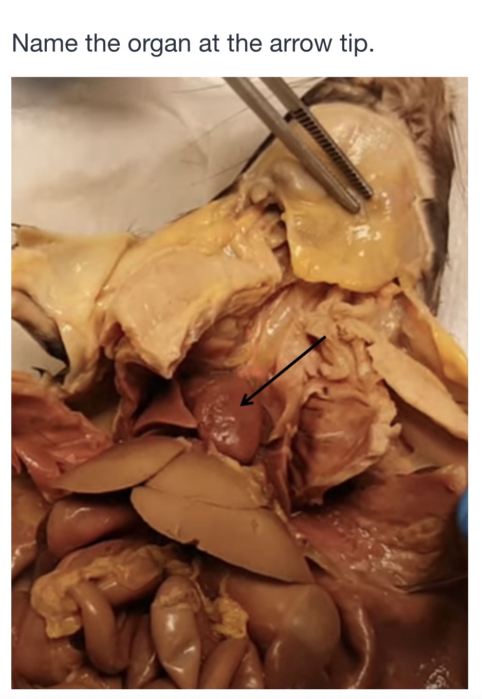 <p>name the organ at the arrow tip</p>