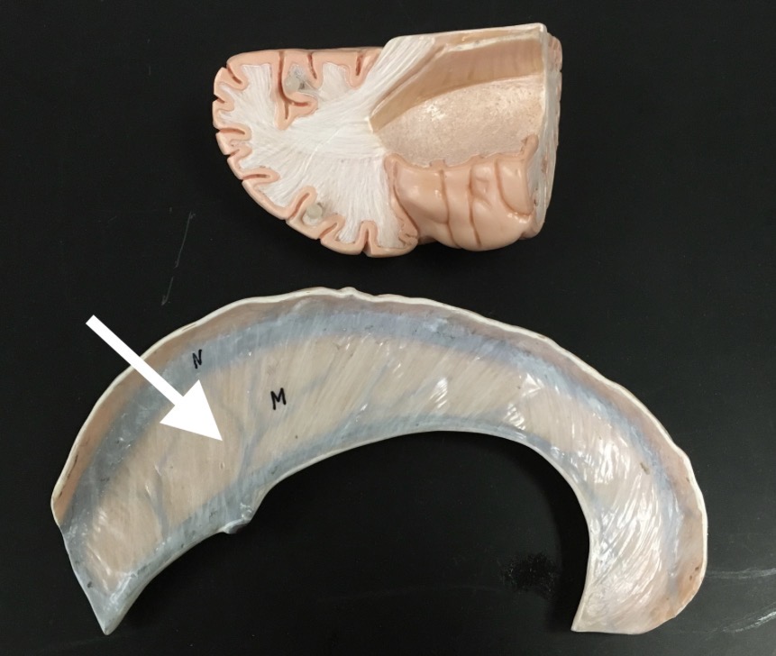 <p>What is the arrow pointing to?</p>