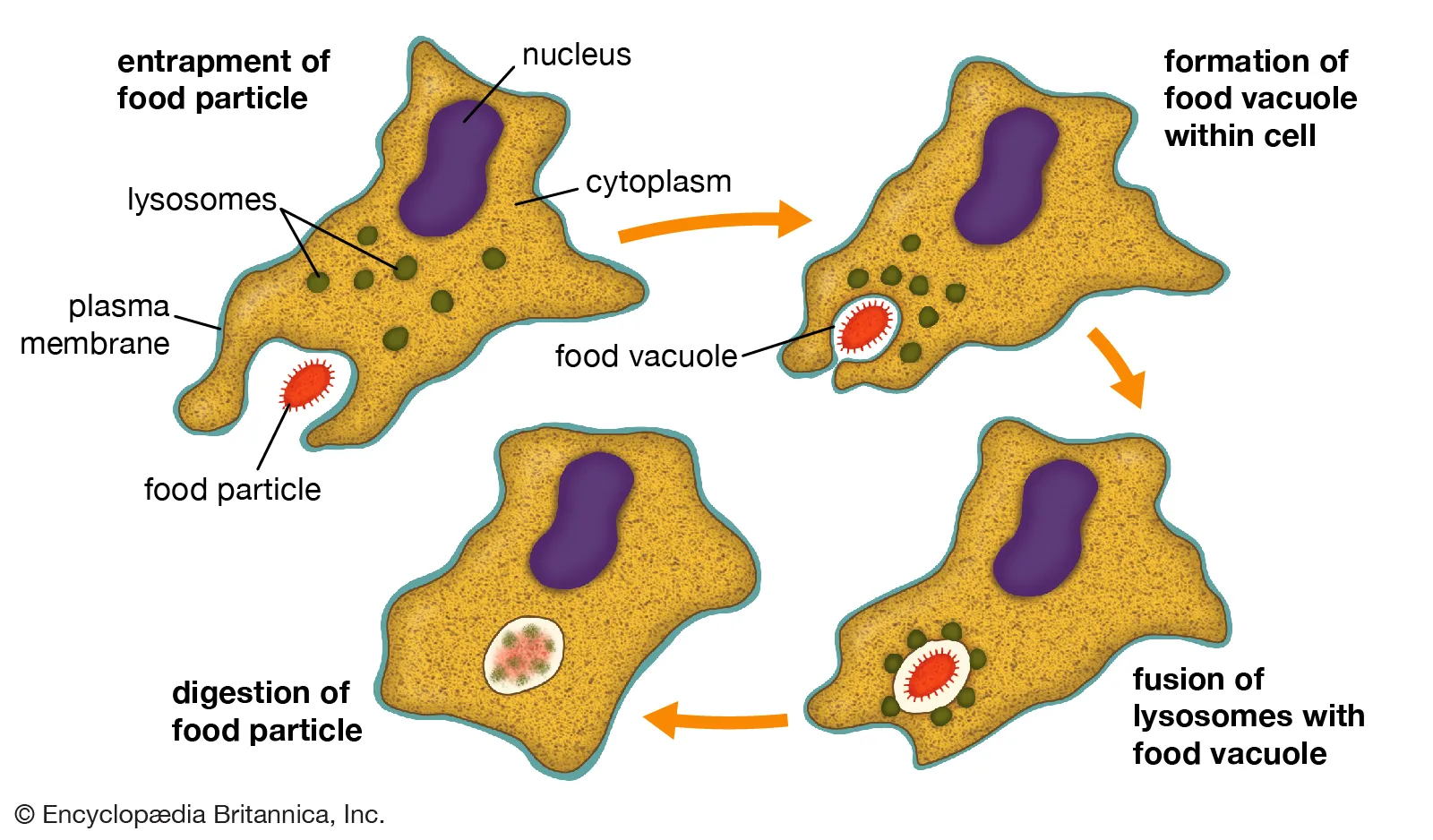 <p>What inflammatory process is illustrated?</p>