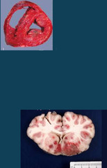 <p>A cow presents with pneumonia, synovitis, endocarditis/myocarditis, and thromboembolic meningeencephalitis (TEME). Necropsy shows septicemia. Thoughts?</p>