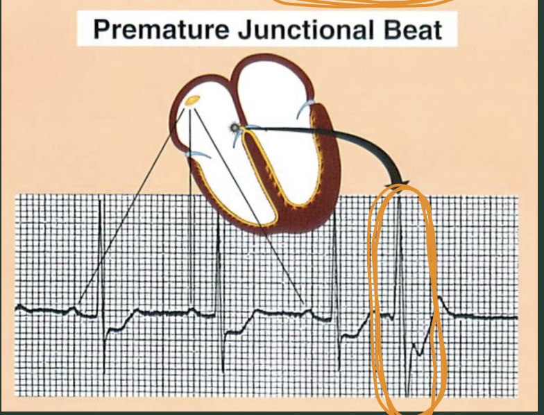 <p>What makes this a PJB?</p>