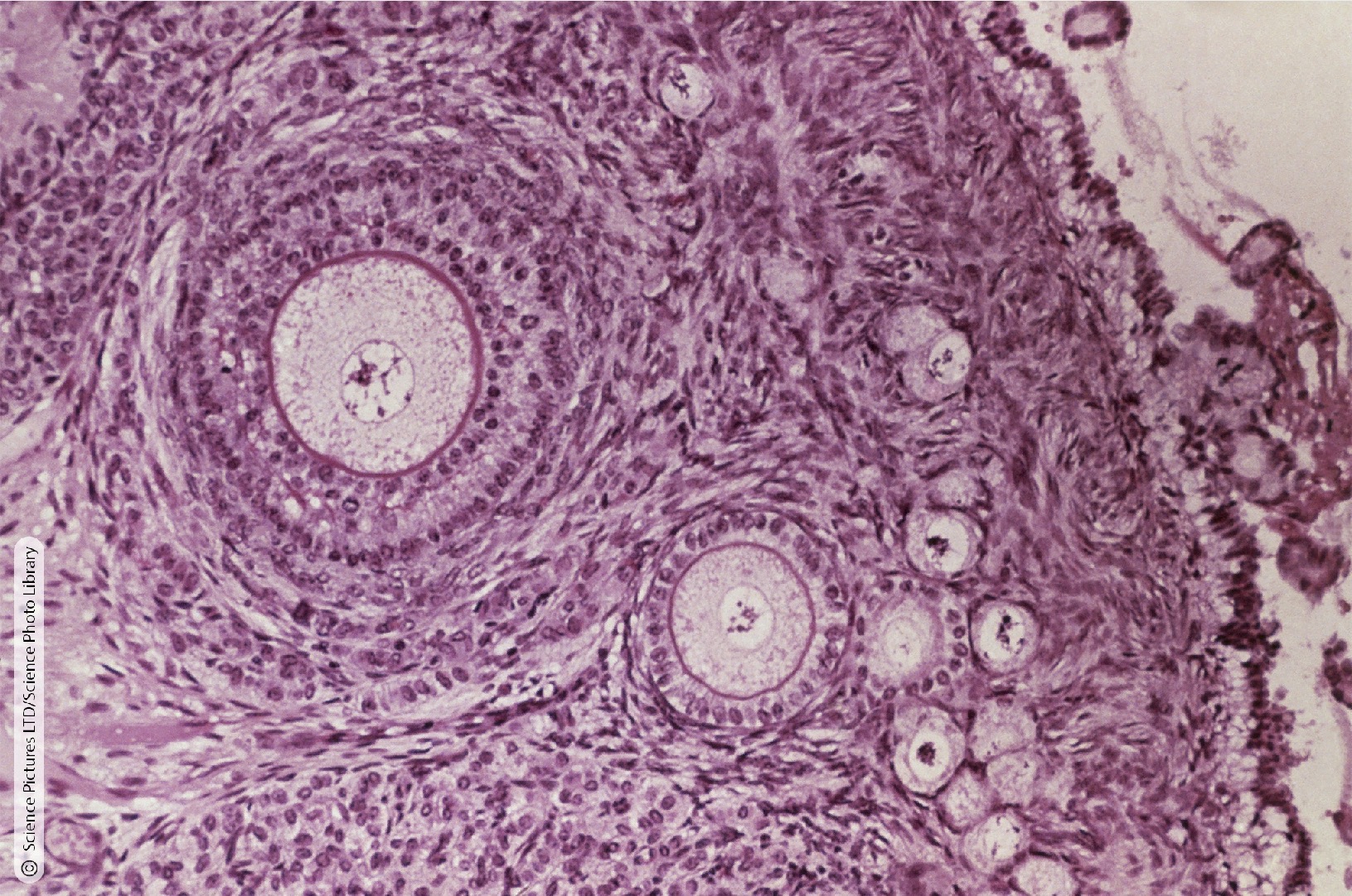 <p>Identify the Histology</p>