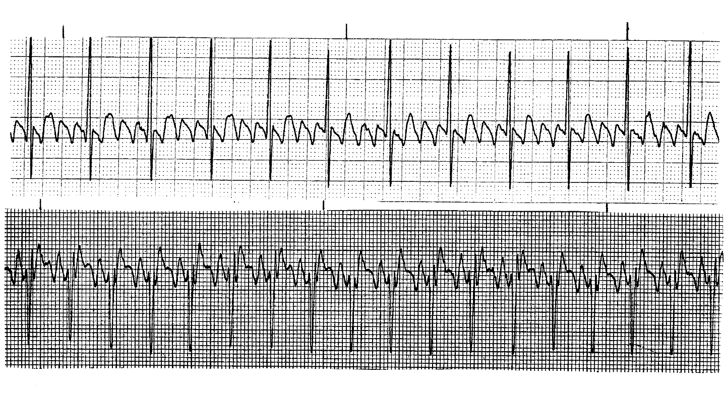 <p>What ECGS are these? </p>