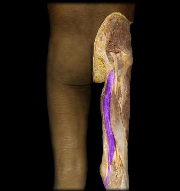<p>What is this muscle called?</p>