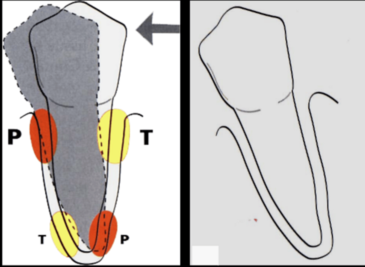 <p>What type of movement is shown here?</p>