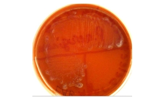 <p>What is this </p>