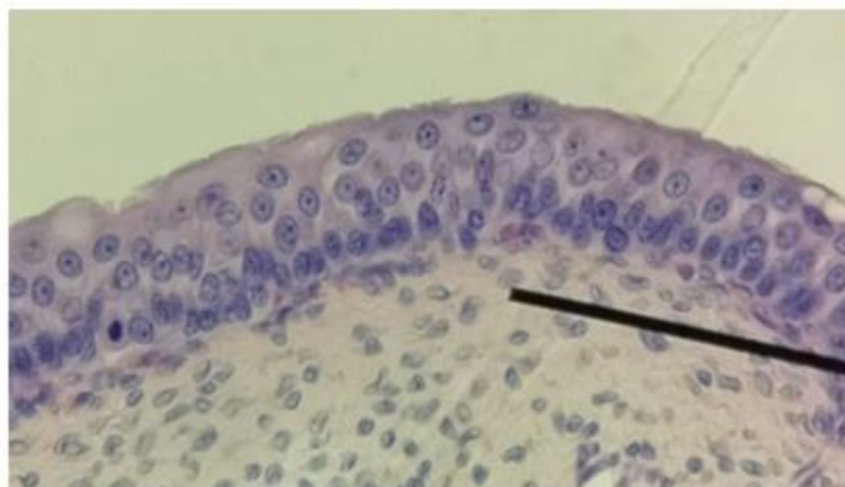 <p>transitional epithelial tissue and  urinary bladder</p>