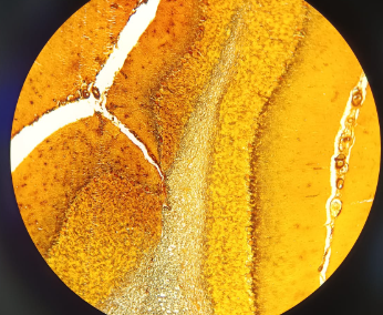 <p>Cerebellum - AgNO3</p><ul><li><p><strong>Organization:</strong> <strong>Gray matter outside</strong>, <strong>white matter inside</strong>.</p></li><li><p><strong>Layers:</strong> Contains <strong>three layers</strong> of cells.</p></li><li><p><strong>Key Cell:</strong> Features large <strong>Purkinje cells</strong> (referred to by the professor as "protein cells")</p></li></ul><p></p>