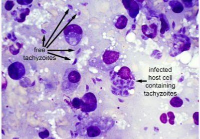 <p>What pathogen/disease is portrayed here? What is the most common source?</p>