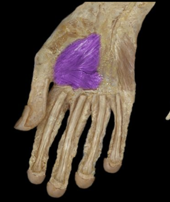 <p>What the highlighted structure is acting on the <strong><mark data-color="#f3b1cb" style="background-color: rgb(243, 177, 203); color: inherit;">Thenar Group</mark>.</strong> What muscle is this called?</p>