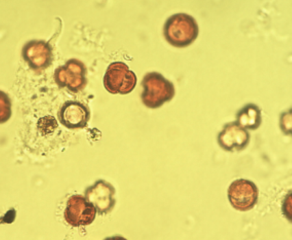 <p>Identify the pollen grains to the <strong>Family</strong> and <strong>Genus</strong></p>