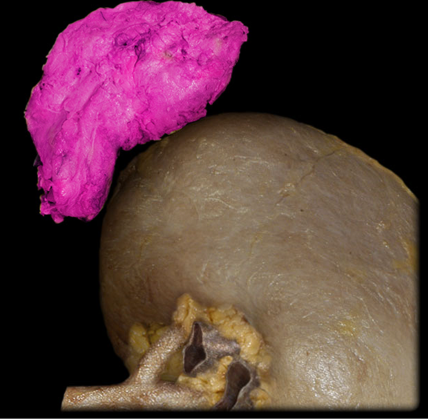 term image