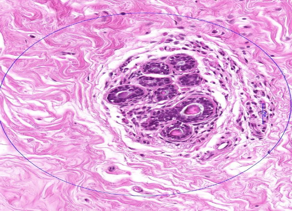 <p>mammary gland normal composition</p>