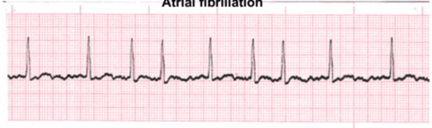 <p>400-600 bpm</p>