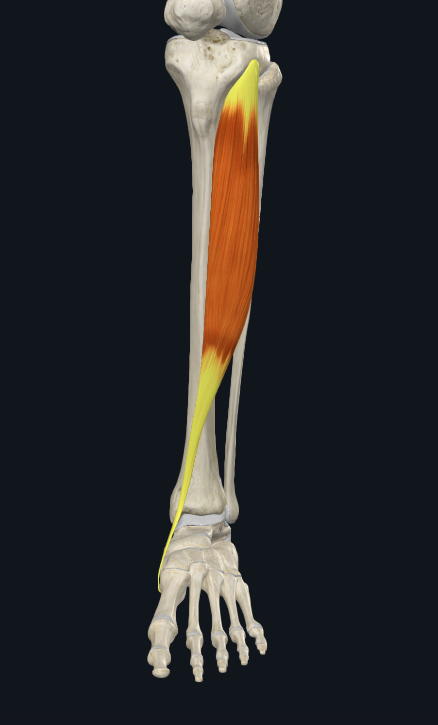 term image