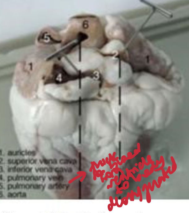 <p>Deoxygenated blood enters the <strong>right atrium</strong> via the vena cava, passes to the <strong>right ventricle</strong>, and is pumped to the lungs via the pulmonary artery. Oxygenated blood returns via the pulmonary veins to the <strong>left atrium</strong>, moves to the <strong>left ventricle</strong>, and is pumped to the body through the aorta</p>