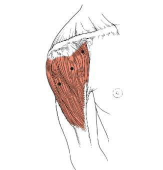 <p>What muscle is this?</p>