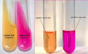<p>Urea agar test</p>