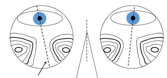 <p>Measurements were taken poorly - which measurements and what are the effects of this</p>