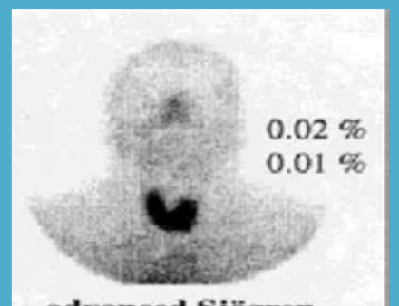 <p>what could this salivary test indicate </p>