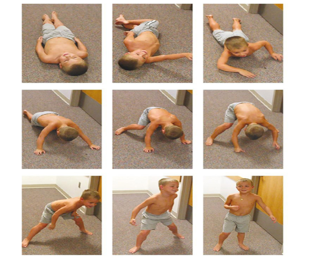 <p>A sign of proximal muscle weakness where a child uses their hands to “climb up” their legs to stand from a sitting or lying position</p>