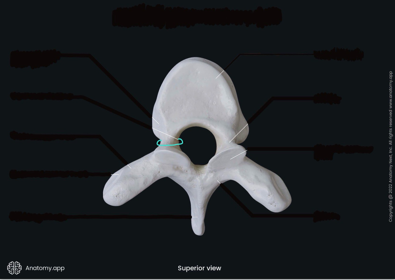 <p>what is the highlighted bony landmark</p>