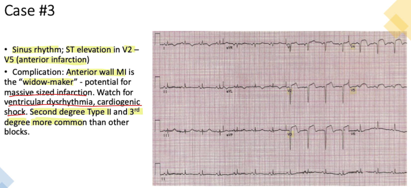 <p><strong>Anterior wall</strong></p>