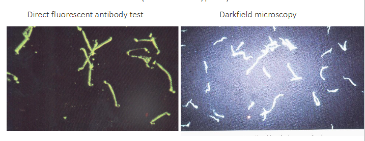 <p>- treponema pallidum (a spirochaete, or spiral bacterium) (the cause of syphillis)</p>
