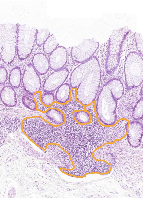 <img src="https://assets.knowt.com/user-attachments/4eb4a21b-56aa-43f0-84aa-5f1591c91624.png" data-width="100%" data-align="center" alt="knowt flashcard image"><p></p>