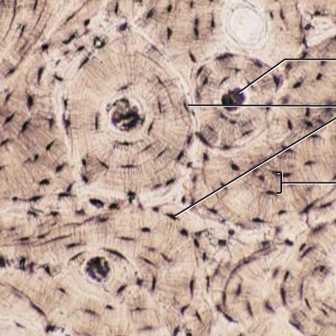 <p><span>Calcified matrix containing many collagen fibers</span></p>
