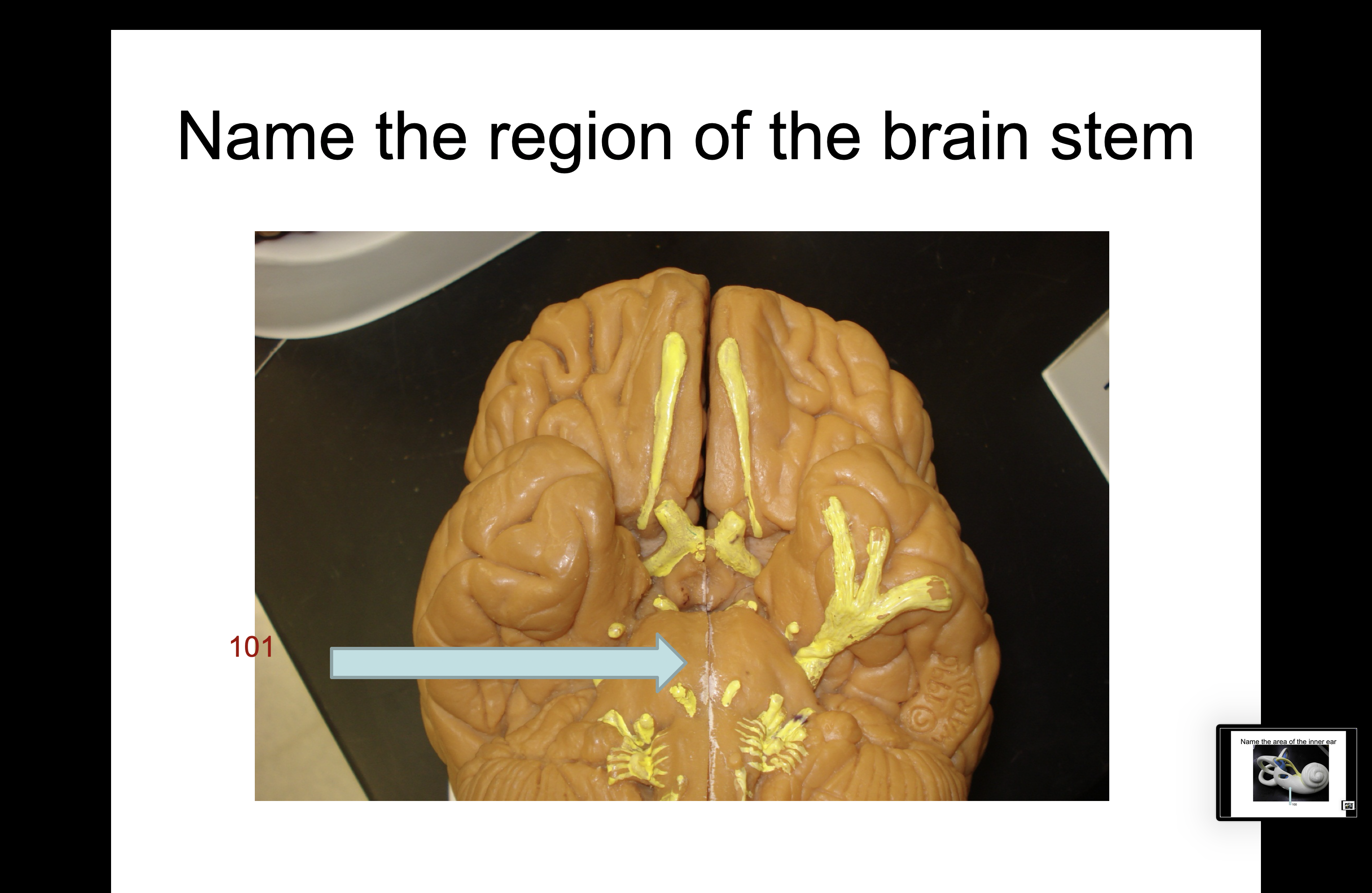 <p>101</p>