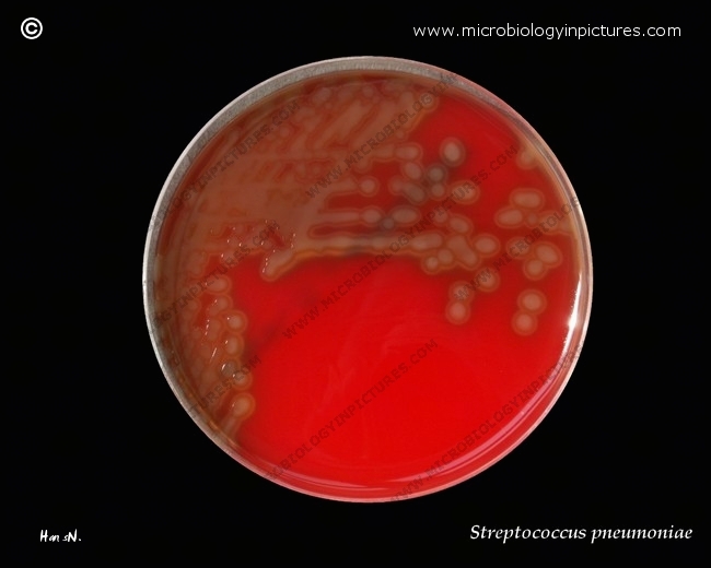 <p>What type of hemolysis pattern is this?</p>