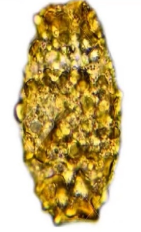 <p>specific type of egg, and nematode</p>