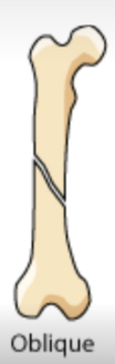 <p>angular</p>