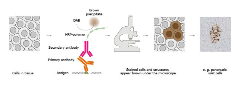 <p>In IHC, you use an antibody against the protein you want to detect:</p><p>Anti-iNOS antibody → binds iNOS</p><p>Anti-HERV-K antibody → binds HERV-K protein</p><p>The antibody is then detected using an enzyme system, commonly horseradish peroxidase (HRP). When the DAB chromogen is added, HRP converts DAB into an insoluble brown precipitate at the location where the target protein is present</p>