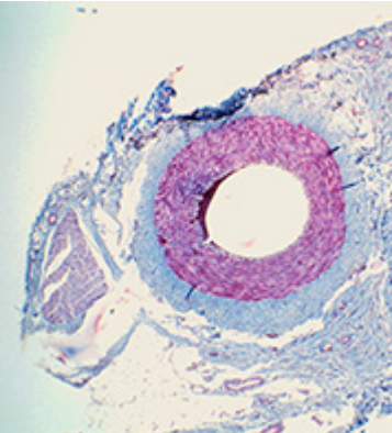 <ol><li><p><strong>thick smooth muscle tissue</strong> to <strong>withstand</strong> high blood pressure</p></li><li><p><strong>thick elastic tissue</strong> stretches and recoils to <strong>maintain </strong>blood pressure</p></li><li><p><strong>narrow lumen</strong> to <strong>maintain</strong> blood pressure</p></li><li><p><strong>smooth endothelium</strong> to reduce friction</p></li></ol><p></p>