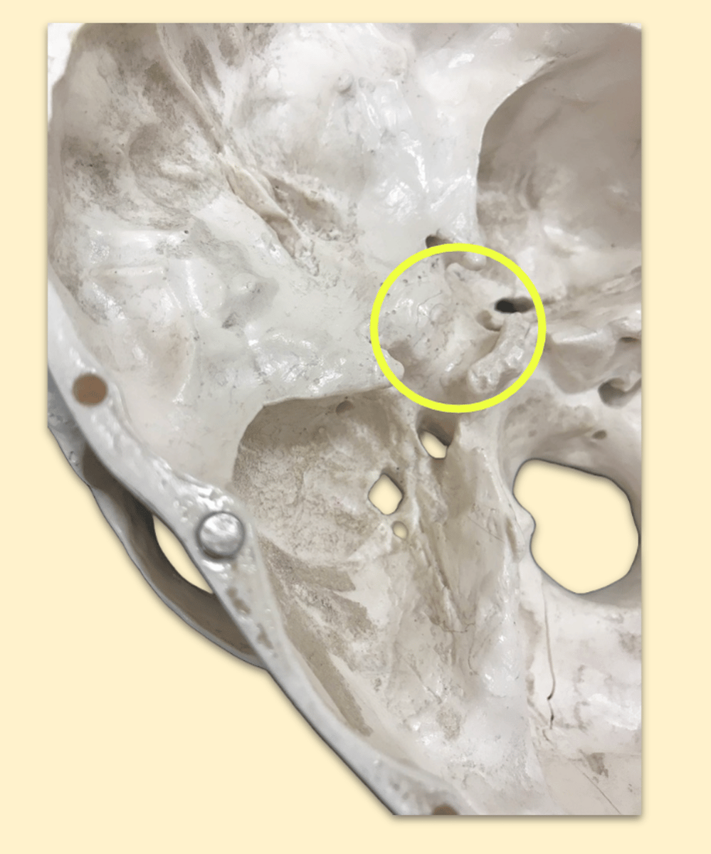 knowt flashcard image